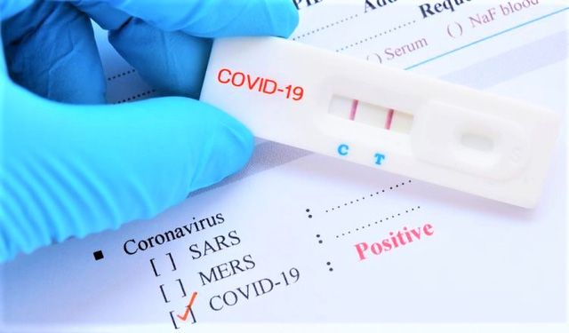 Lập đoàn kiểm tra việc kinh doanh test kit xét nghiệm nhanh và PCR