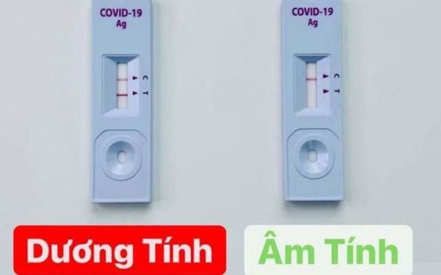 Tại sao lại có dương tính giả trong xét nghiệm COVID -19?