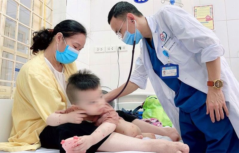 Hà Nội: Xuất hiện chùm ca bệnh tay chân miệng, thủy đậu trong trường học